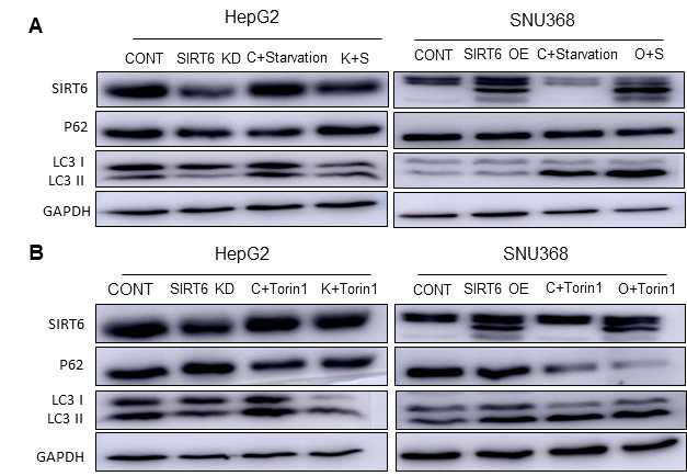 간암세포주 HepG2와 SNU368에서 SIRT6 silencing 및 overexpression 후 starvation과 torin1을 처리한 후 autophagy 관련 signaling 변화 연구
