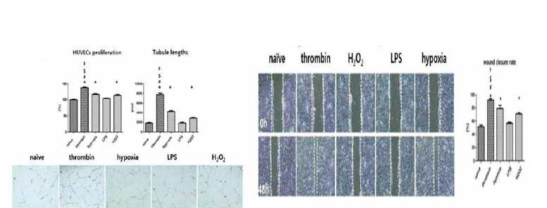 엑소좀 처리가 HUVEC 세포의 성장과 혈관 생성분석 및 scratch assay를