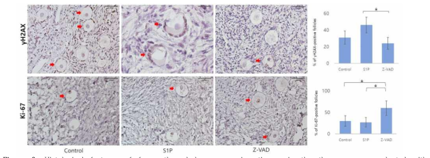 Histological features of frozen-thawed human ovarian tissues in the three groups evaluated with immunohistochemical staining for Ki-67 (magnification´200, control: n=19, S1P: n=18, Z-VAD: n=19) and γH2AX (control & Z-VAD: magnification´200, S1P: magnification´400)(control: n=18, S1P: n=19, Z-VAD: n=18). Red arrows indicate Ki-67-positive or γH2AX-positive primordial follicles