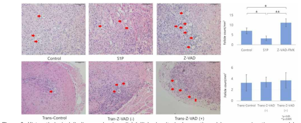 Histopathological findings and primordial follicle density in frozen-thawed human ovarian tissues and human ovarian tissues after xenotransplantation (magnification´200). Student’s independent t-test showed that the follicular density was significantly different among the three groups (each group, n=20) in frozen-thawed human ovarian tissue. However, there was no significant difference in follicle density among three groups (control: n=10, trans-Z-VAD (-) & (+): n=20) in human ovarian tissue after transplantation. Red arrows indicate primordial follicles