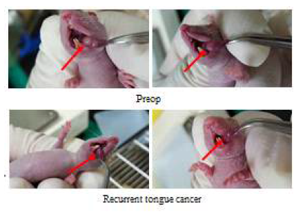 ‘Selection of recurrent subpopulation’기법을 이용한 재발성 구강암 모델 확립