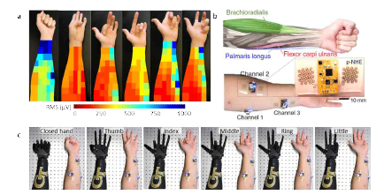 a) 이상적인 센서 부착 위치를 확인하기 위하여 주먹, 엄지/검지/중지/약지/새끼 손가락을 접는 제스쳐를 취했을 때 RMS 신호의 강도를 보여주는 EMG mapping 데이터 b) palmaris longus, brachioradialis, flexor carpi ulnaris의 세가지 근육을 타겟으로 센서의 부착 위치를 보여주는 도식도와 실물 사진 c) 세개의 센서에서 전송되는 EMG를 통해 조정되는 로봇손을 보여주는 사진