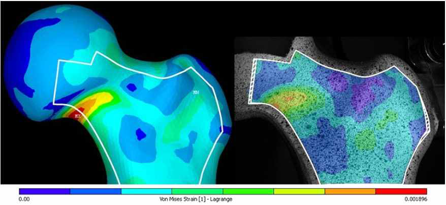 고관절 압축 시험의 FEM 해석 결과(왼쪽)와 이미지 상관법 결과(오른쪽)