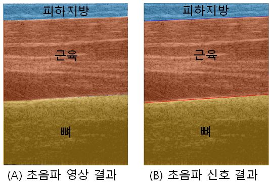 초음파 영상과 신호기반 체성분 측정 결과