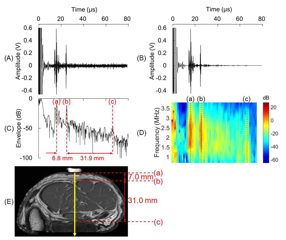 초음파 측정 장치에서 Ex vivo 티슈로부터 수집된 신호와 MRI 영상-(A) 티슈에서 수집된 대표적인 초음파 신호, (B) 신호처리 후의 초음파 신호, (C) 절대값을 취한후의 신호, (D) 초음파 신호의 frequency map, (E) 티슈 샘플 MR 영상