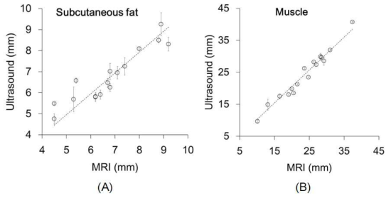 초음파로 측정한 티슈 두께와 MR영상으로부터 획득한 티슈 두께와의 상관관계