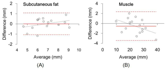 초음파로 측정한 티슈 두께와 MR영상으로부터 획득한 티슈 두께의 Bland-Altman 선도