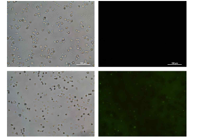 EL-4 세포의 immunostaining 형광 이미지 (위) TAT 고정화가 되지 않은 CRISPR-단백질 나노입자 적용한 EL-4 cell. (아래) TAT-CRISPR-단백질 나노입자 적용한 EL-4 cell