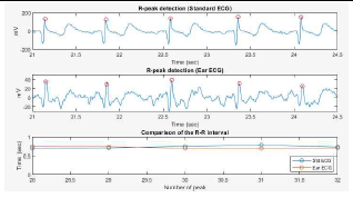 표준 ECG 및 Ear ECG 측정 비교