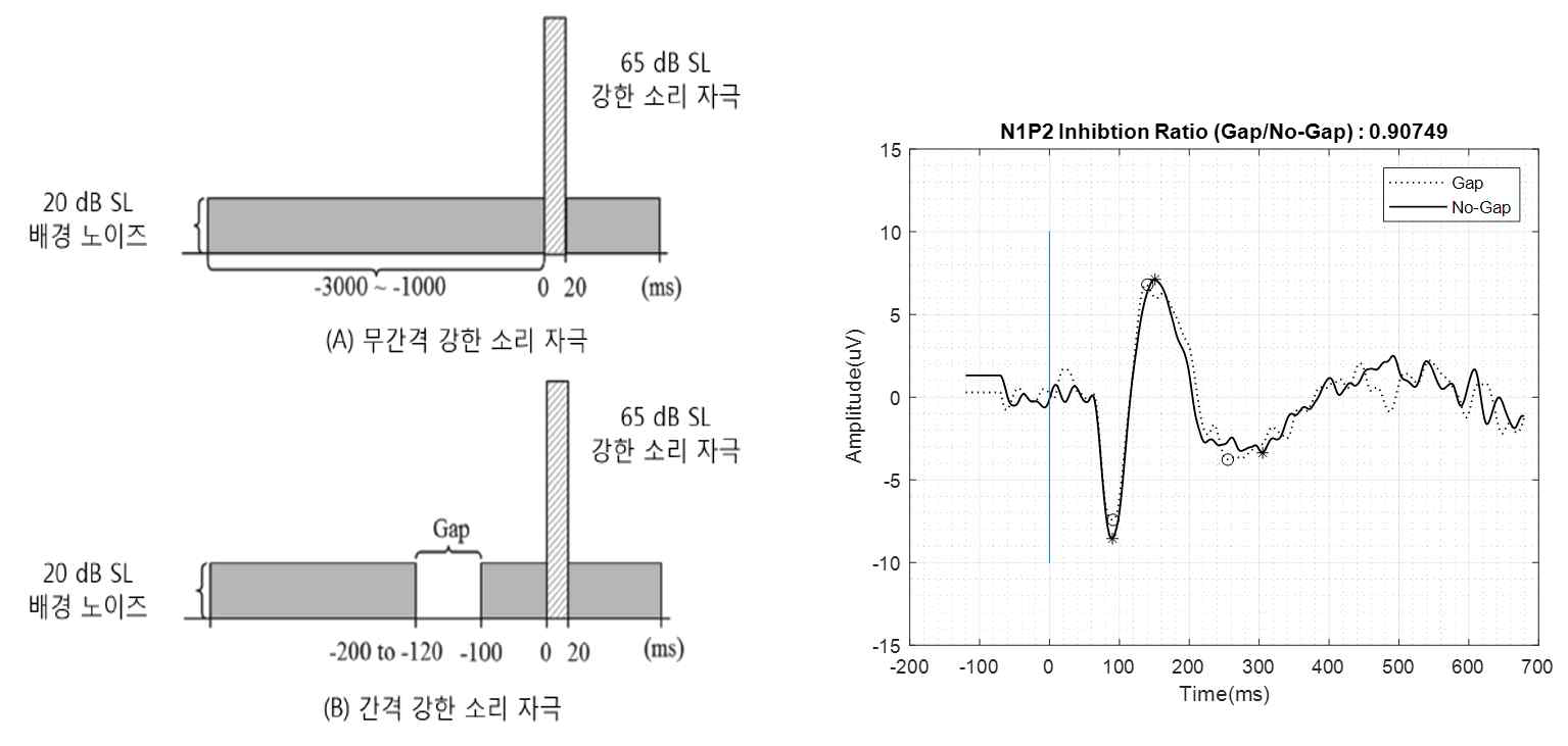 펄스 전 간격법 프로토콜(좌) 및 이명 환자에서 측정된 청성유발반응 (우)