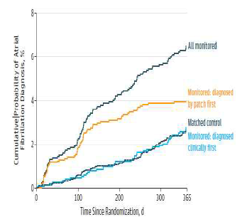 첫 심방세동 진단 누적률의 적극적 모니터링 그룹과 일반관찰그룹 간 차이