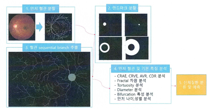 안저 혈관 분할 및 렌드미-크 분할을 통한 신체질환 분류 에측 모식도