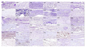 Immunohistochemical staining results of RUNX-2 (× 40)