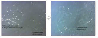 인체 모낭 멜라닌줄기세포 배양 시도 중 섬유아세포 오염
