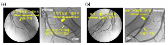 혈관 조영 검사(angiography)를 통한 혈관 그래프트 시작품을 적용한 부위에서의 혈관 개통성(vascular patency) 분석. (a) 고식적 혈관 그래프트 및 (b) 형상기억 고분자 기반 혈관 그래프트(diffuser type)