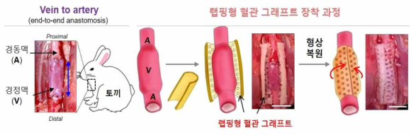 토끼 vein to artery 모델 제작 및 문합부위의 랩핑형 혈관 그래프트 장착 과정