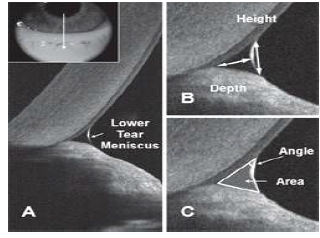 Tear OCT측정법