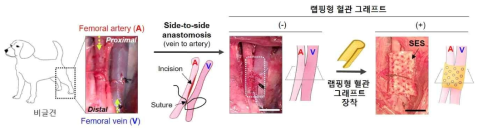 비글견 vein to artery 모델 제작 및 문합 부위의 랩핑형 혈관 그래프트 장착 과정