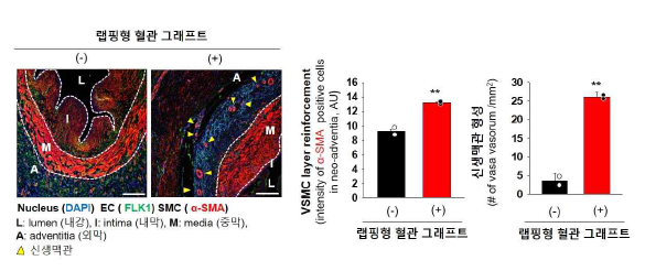 랩핑형 혈관 그래프트 장착 유무에 따른 평활근 세포의 이동 양상 및 신생 혈관 형성 확인. 공초점 레이저 주사 현미경을 이용한 Flk-1과 α-SMA의 면역 염색을 통한 평활근 세포층 그리고 신생 혈관 형성의 확인과 혈관 평활근 세포(VSMC)층의 보강과 신생 혈관 형성의 정량적 그래프