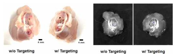 MNP담지 세포 융합 마이크로 구조체의 병변 부위 내 유지 효과 확인