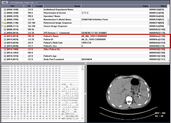 DICOM 파일의 익명화