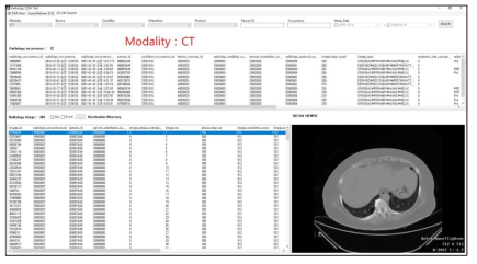 DB 검색 조건 부여한 예시: 영상장비(Modality) = 전산화 단층촬영 장비(CT)