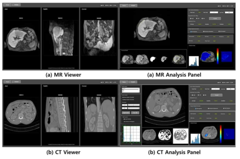 통합분석 소프트웨어 화면(GUI): (a) MRI영상 처리화면, (b) CT영상 처리화면