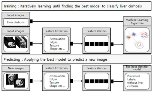 간경변(LC) 인공지능 예측 모델 개발 플로우