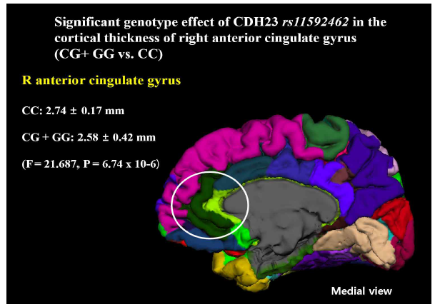 CDH23 유전자의 rs11592462 SNP과 우반구의 전대상피질의 두께의 관계