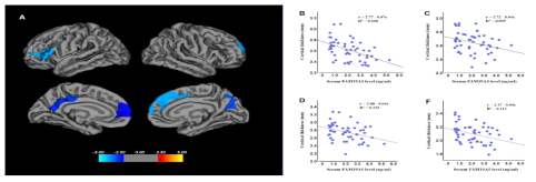 (a)FAM19A5 혈중 농도와 관련된 뇌피질 두께 감소영역, (b) FAM19A5 혈중 농도와 관련된 뇌피질 두께와의 상관관계 Brain, Behavior and Immunity, 2020)
