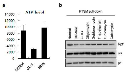 세포내 ATP 수준과 프로테아좀 구조 변화 관찰 a. 글루코스 결핍에 의한 세포내 ATP 감소 확인 b. 세포내 ATP 결핍을 유도하는 조건들에 의한 프로테아좀 조절입자의 분리