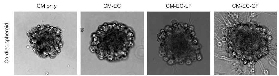 다양한 세포 조합으로 이루어진 심장 스페로이드