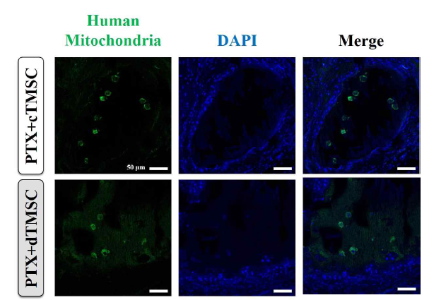 실험동물에 이식했던 alginate-beads 내의 세포 검증. Human mitochondria 항체를 사용하여 면역형광 염색을 진행한 후 공초점현미경으로 관찰