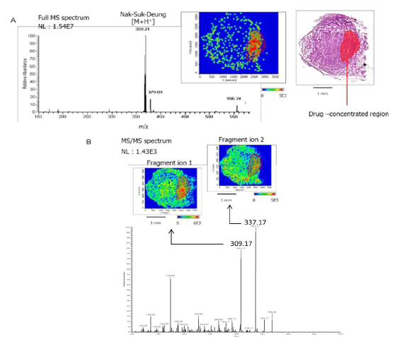 Images of the distribution of Voa and fragment ions thereof from a Voa-treated tumor tissue section. (A) The iMS image of Voa generated from the MS spectrum is shown with the histological image (H&E). Localization of the drug within the tissue is indicated in red. (B) The iMS image of the fragment ions from Voa generated from the MS/MS spectrum also localize the compound to the same region of the tissue