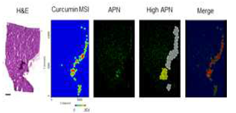 The co-localization of CUR and APN. Comparison of CUR MSI (precursor ion) and immunofluorescence staining of the target protein, APN, on tumor tissue of CUR-treated mice