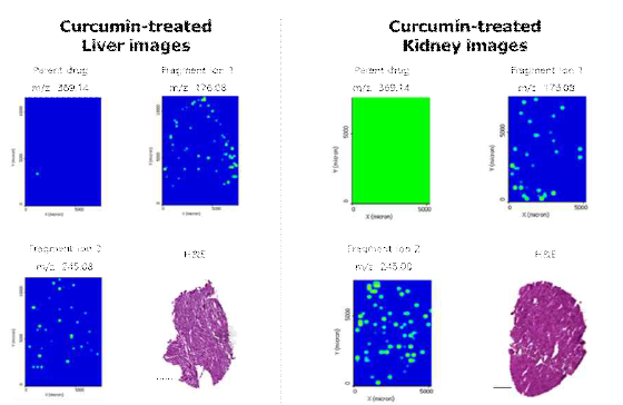 Images of distribution of CUR and its fragment ions in CUR-treated Liver and kidney tissue section