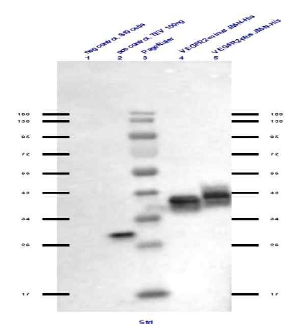 Westernblot of the test expressions from P2 viral stocks – soluble fractions were applied. Extract from Sf9 cells was used as negative control and purified His-tagged TEV-protease as positive control