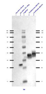Western blot of the test expressions from P2 viral stocks – soluble fractions were applied. Extract from Sf9 cells was used as negative control and purified His-tagged TEV-protease as positive control