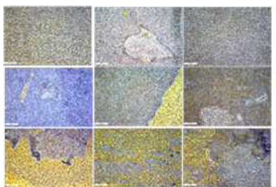 Examples of thin-layer surfaces generated from melanoma cancer tissues with varying spray cycles