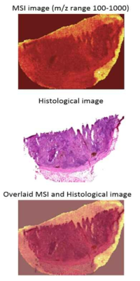 Overview of tumor tissue images using MSI. Data are systematically acquired in an array format within H&E stained tissue