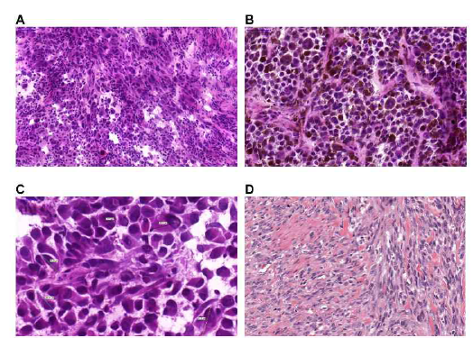 Four tumor tissue images from patients undergoing treatment in the clinic. These were processed by the biobank workflow that has been developed and implemented at the Biomedical Center in Lund