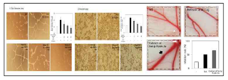 정력자 추출물의 in vitro 와 in vivo 혈관신생 저해 효과