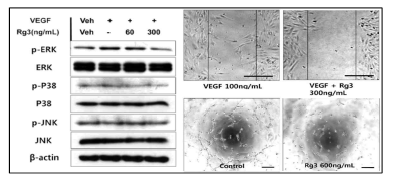 Rg3의 혈관 내피 전구세포의 성장인자 저해와 성장 억제