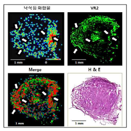 조직 내에서 Voa VEGFR 단백질 간의 결합 비교분석