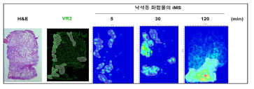 위암 환자 유래 PDX 조직에서 Voa와 표적 단백질의 분포 및 결합 검증