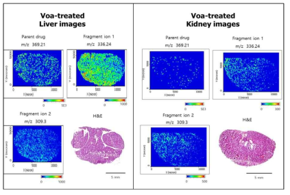 마우스의 간, 신장 조직 내 Voa 분포 이미징
