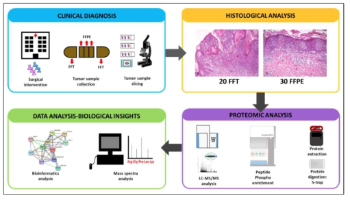 Experiment design and general pipeline for the clinical proteomics and phosphoproteomics workflow