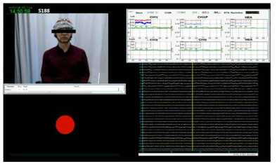 뇌기능 모니터링 시스템