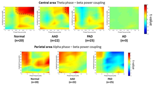 뇌파 Cross-frequency coupling 분석 결과