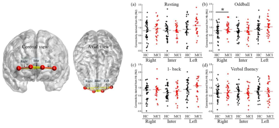 fNIRS 신호를 이용한 기능적 연결성 분석 결과 (HC(n=47), MCI(n=33); p-value *: p<0.05)